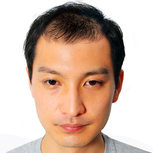気になる薄毛、バレない対策とは