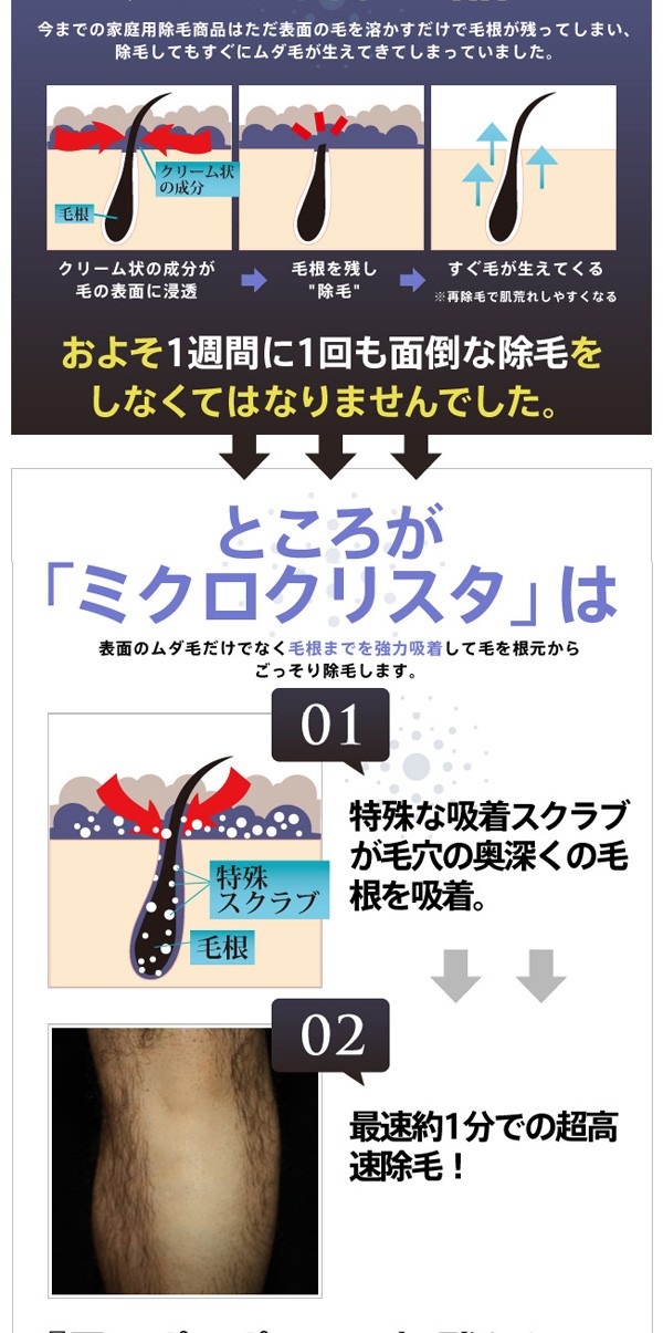 除毛,ムダ毛,脱毛,腕毛,スネ毛,ワキ毛,除毛剤