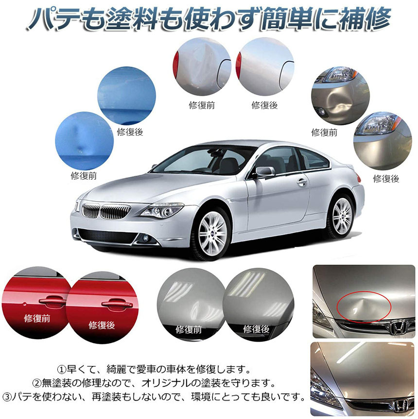 デント修復ツール デントリペアツール 車へこみ修理 塗料無し デントの