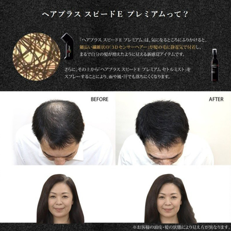 マート アデランス ヘアプラス スピードE プレミアム セトルミスト 5本