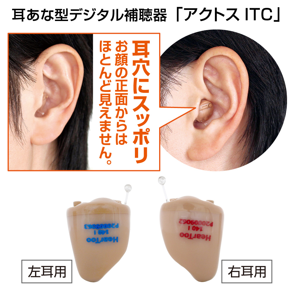 ITC2