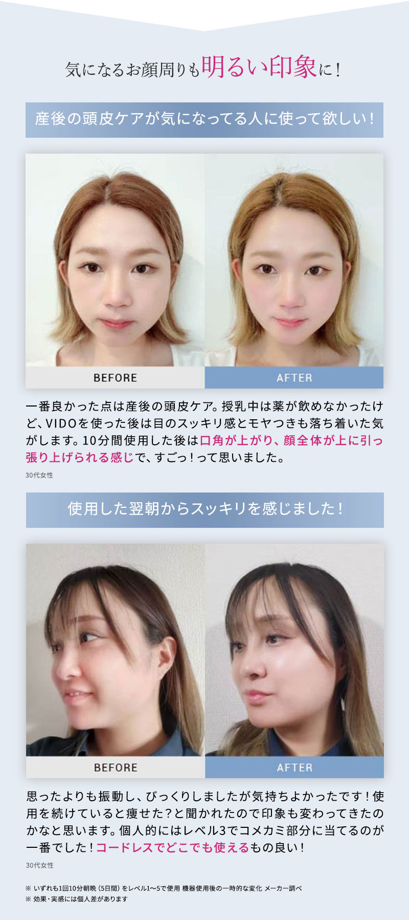 マイトレックス　ビドー　電動ブラシ