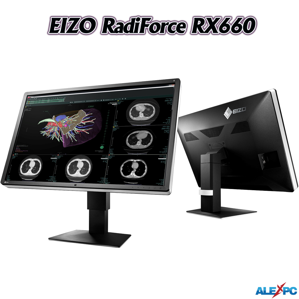 医用画像表示モニター CR、DR、CT、MRI、超音波 EIZO RadiForce RX660 30.0型カラー液晶  省スペース/ベゼルレス/3280x2048/IPS/6メガピクセル DisplayPort/DVI-D : tft0001 : ALEXPC  Yahoo!店 - 通販 - Yahoo!ショッピング