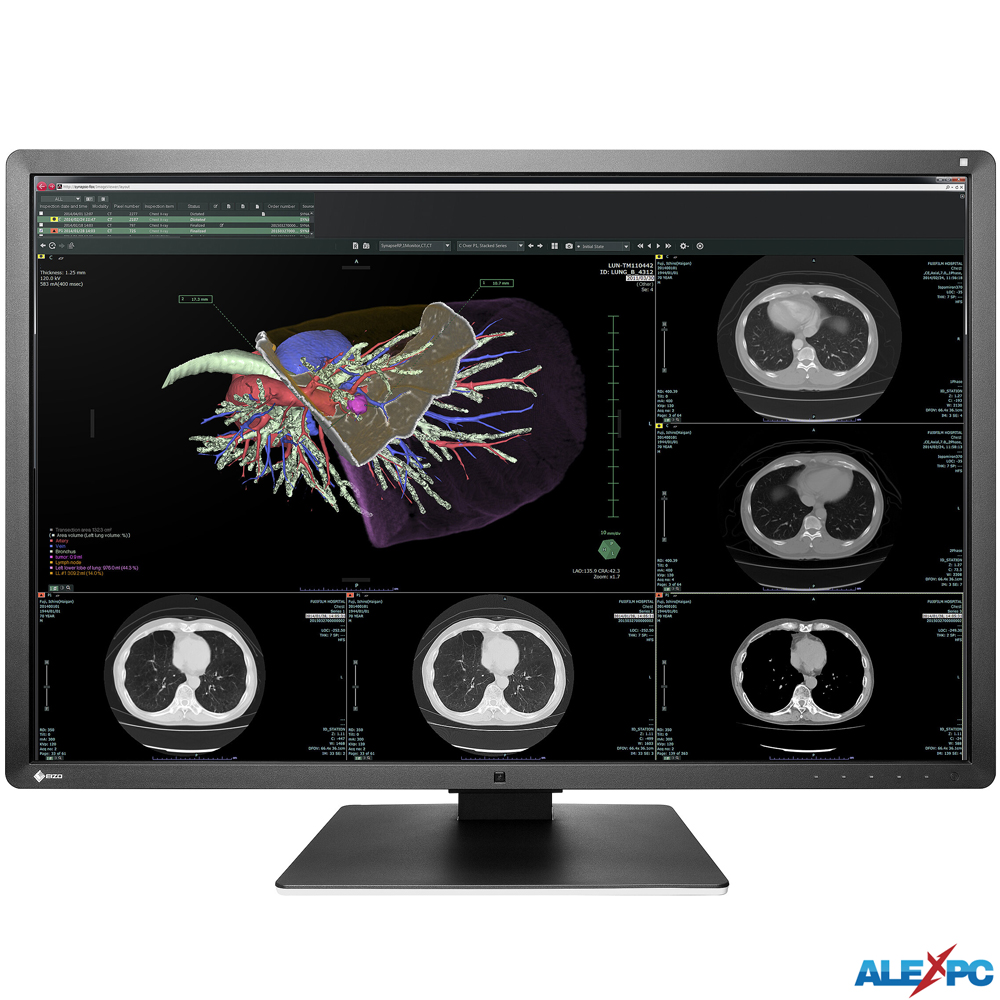 医用画像表示モニター CR、DR、CT、MRI、超音波 EIZO RadiForce RX660 30.0型カラー液晶  省スペース/ベゼルレス/3280x2048/IPS/6メガピクセル DisplayPort/DVI-D : tft0001 : ALEXPC  Yahoo!店 - 通販 - Yahoo!ショッピング