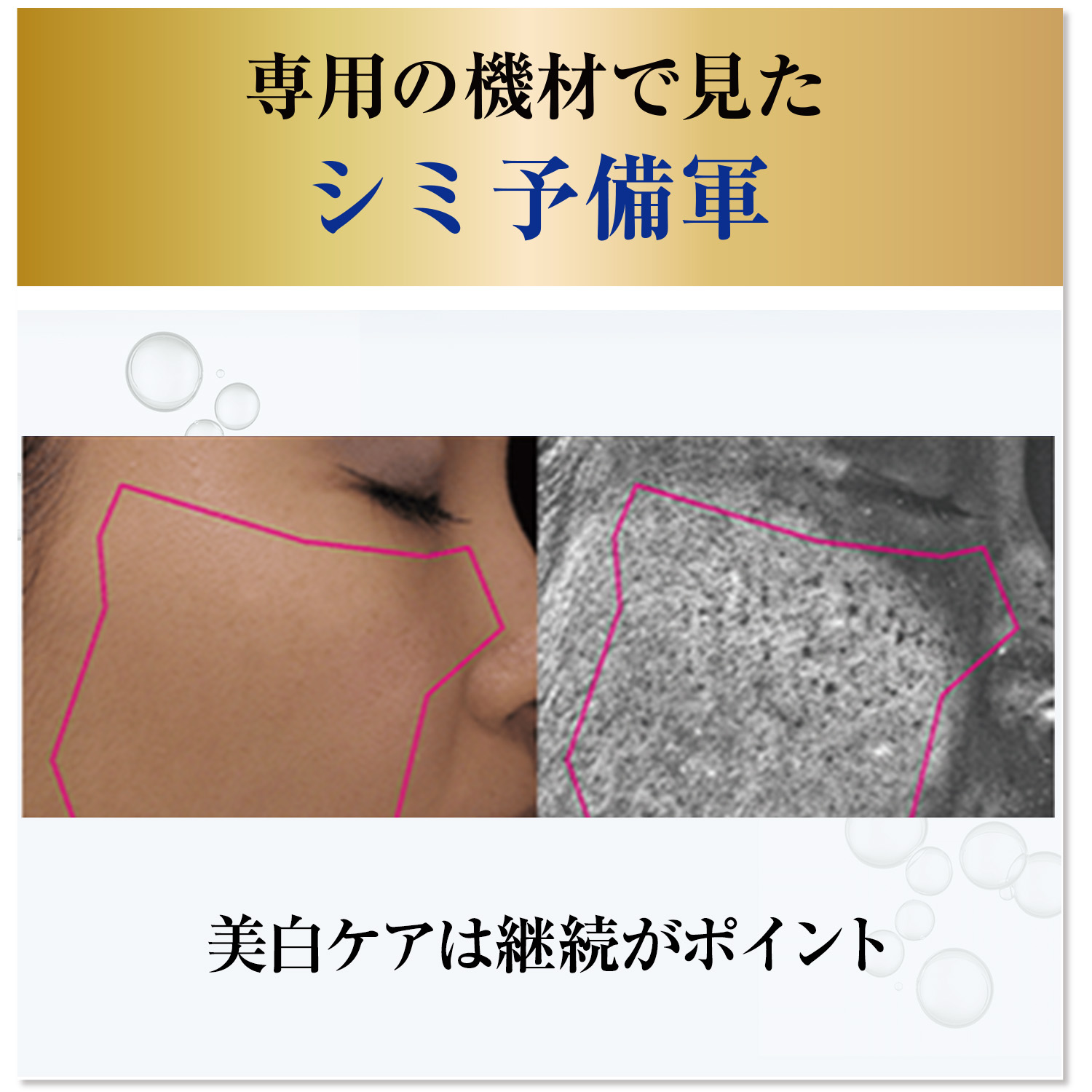 MUNOAGE 公式 ミューノアージュ 薬用美容液 30mL（ダブル