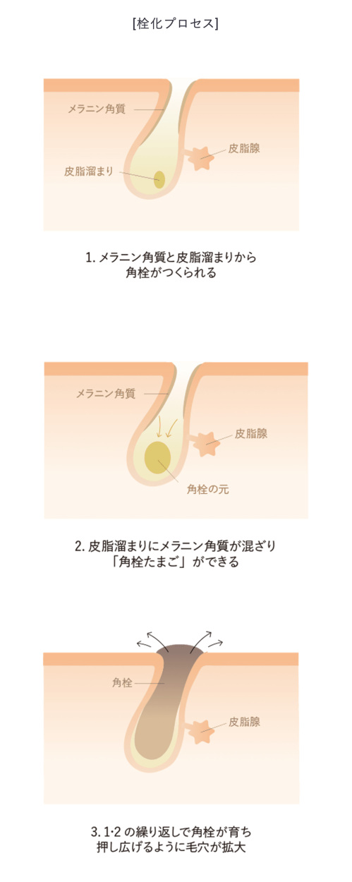 AMPLEUR（アンプルール） クレンジングバーム 毛穴/クレンジング