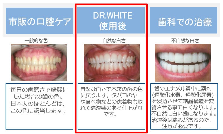 DR.WHITE使用後比較写真