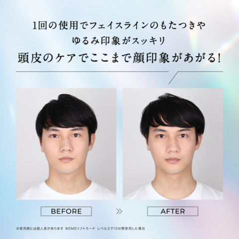 DISM ディズム スキンケア＆リフト プロヘッドデバイス ヘッドマッサージ 美顔器 | DISM | 06