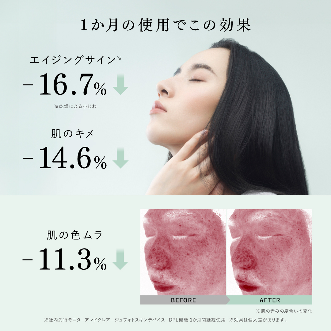 アンドクレアージュ フォトスキンデバイス 光美顔器 美顔器 EMS DPL NIR 家庭用 医師監修 ハリ 引き締め うるおい 透明感 スキンケア 女性用 | アンファー | 05