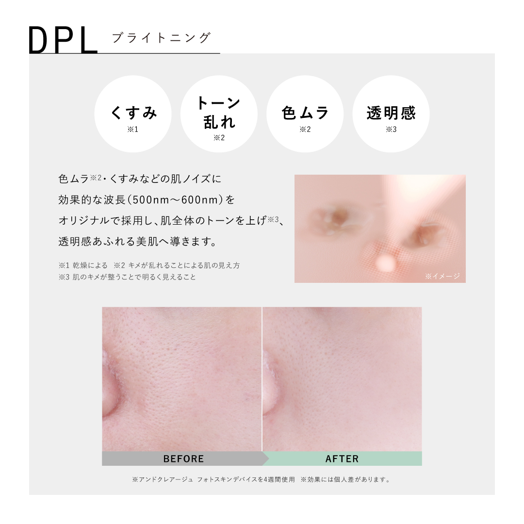 アンドクレアージュ フォトスキンデバイス 光美顔器 美顔器 EMS DPL NIR 家庭用 医師監修 ハリ 引き締め うるおい 透明感 スキンケア 女性用 | アンファー | 08