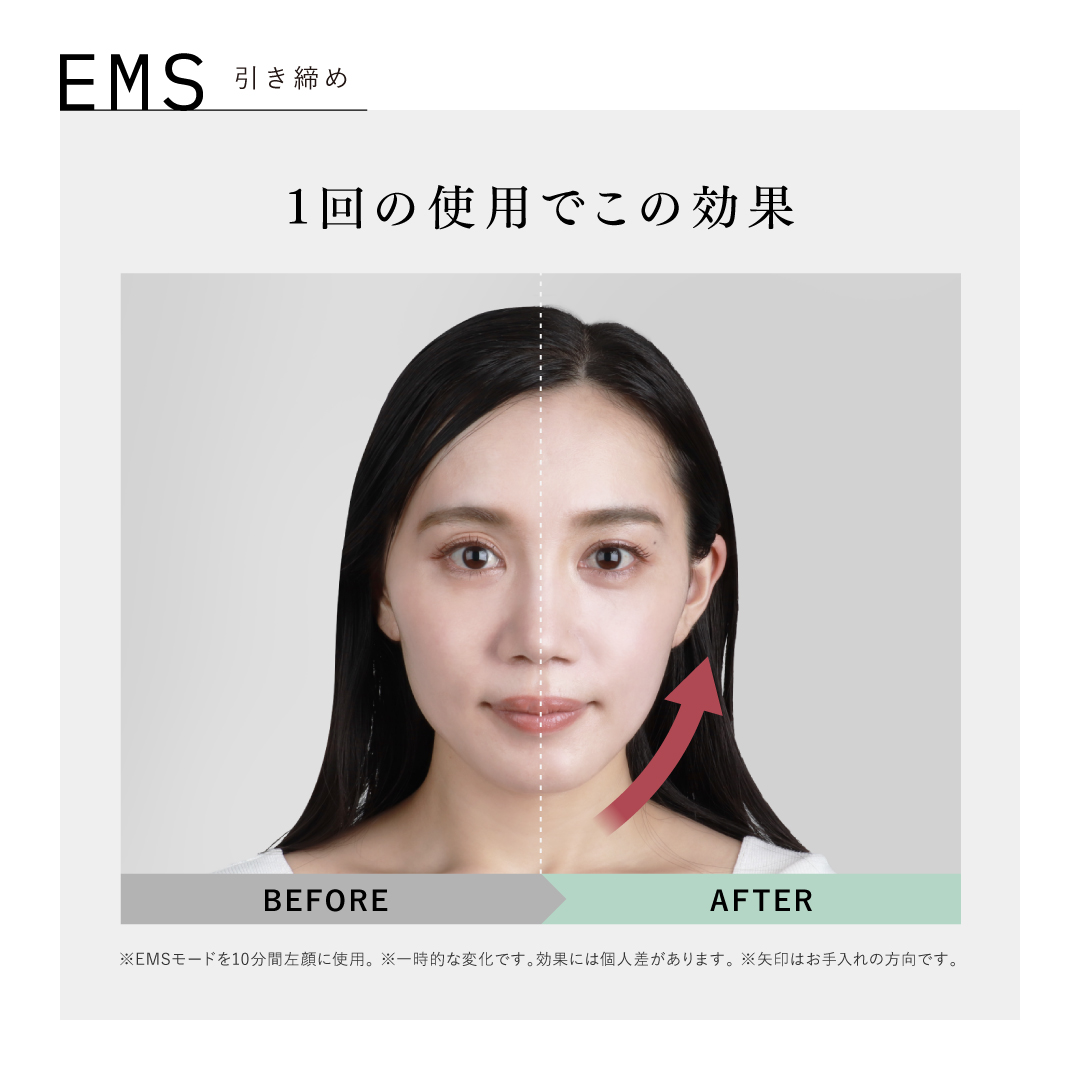 アンドクレアージュ フォトスキンデバイス 光美顔器 美顔器 EMS DPL NIR 家庭用 医師監修 ハリ 引き締め うるおい 透明感 スキンケア 女性用 | アンファー | 11