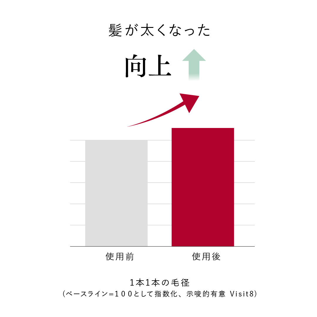 育毛剤 女性 育毛 発毛 薄毛 スカルプＤボーテ アンド クレアージュ メディカルエストロジー スカルプセラム つめかえ用 アンファー 女性用 レディース | スカルプD ボーテ | 10