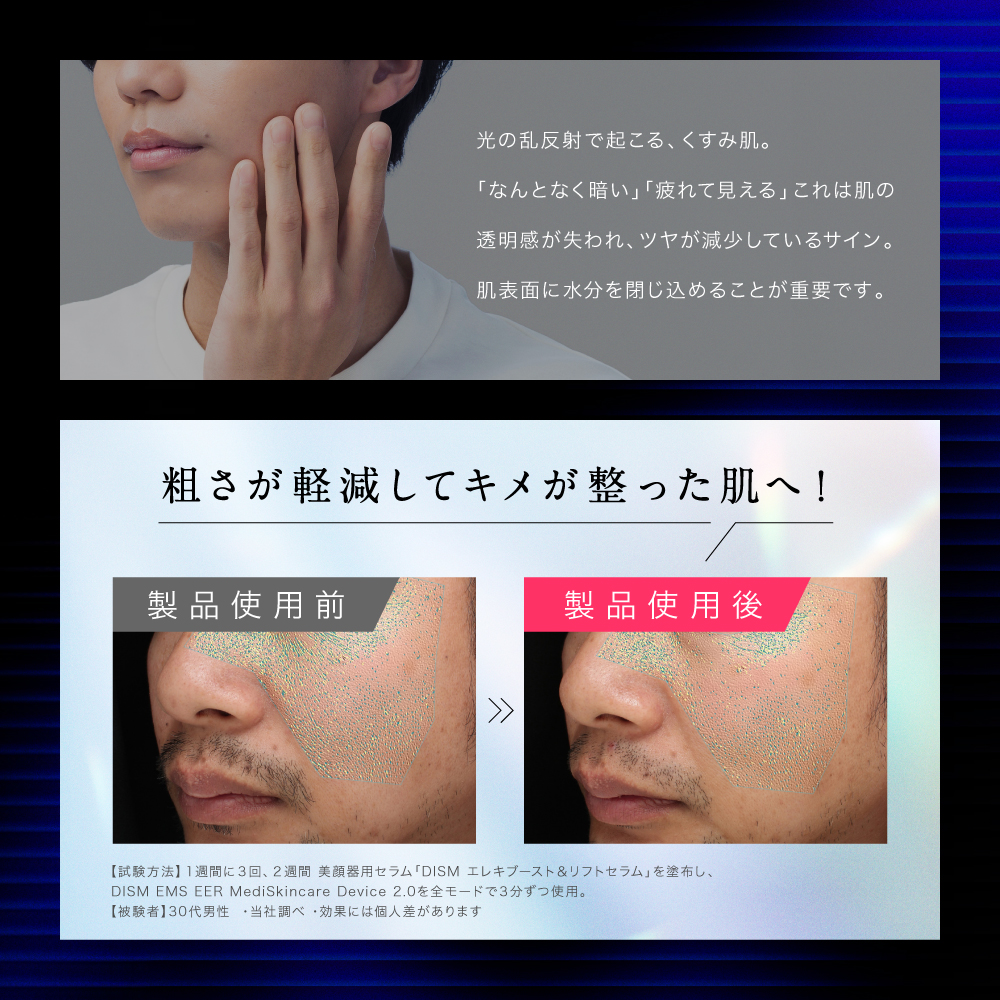 ディズム EMS EERメディスキンケアデバイス 2.0 美顔器 DISM うるおい ハリ肌 コンパクト 充電式 スキンケアデバイス 引き上げ ハリ 肌 リフトアップ スキンケア | スカルプD | 10