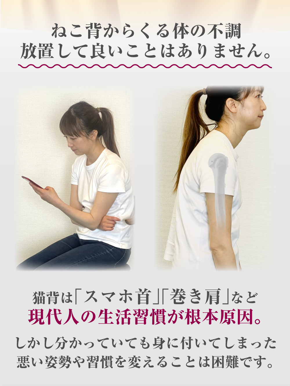 猫背矯正 サムネイル