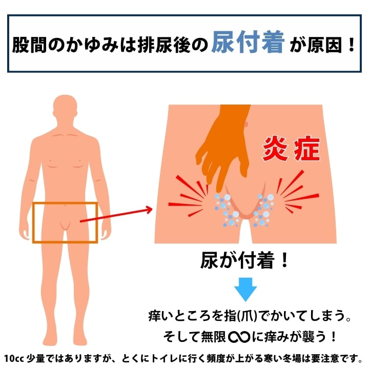 尿漏れパンツ 失禁パンツ 残尿吸収 ちょい漏れ ボクサー 前閉じ 人気 送料無料 あっぷる本舗