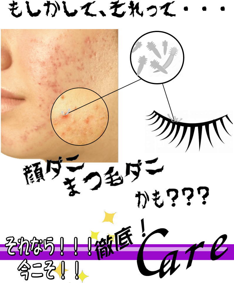 【中古】 あなたの顔にもダニがいる！ 日本製】顔ダニ・まつ毛ダニ・ニキビダニ対策石鹸 薬用 mm素肌ソープ