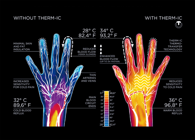 THERM-IC サーミック ヒーティングテクノロジー ウルトラヒート