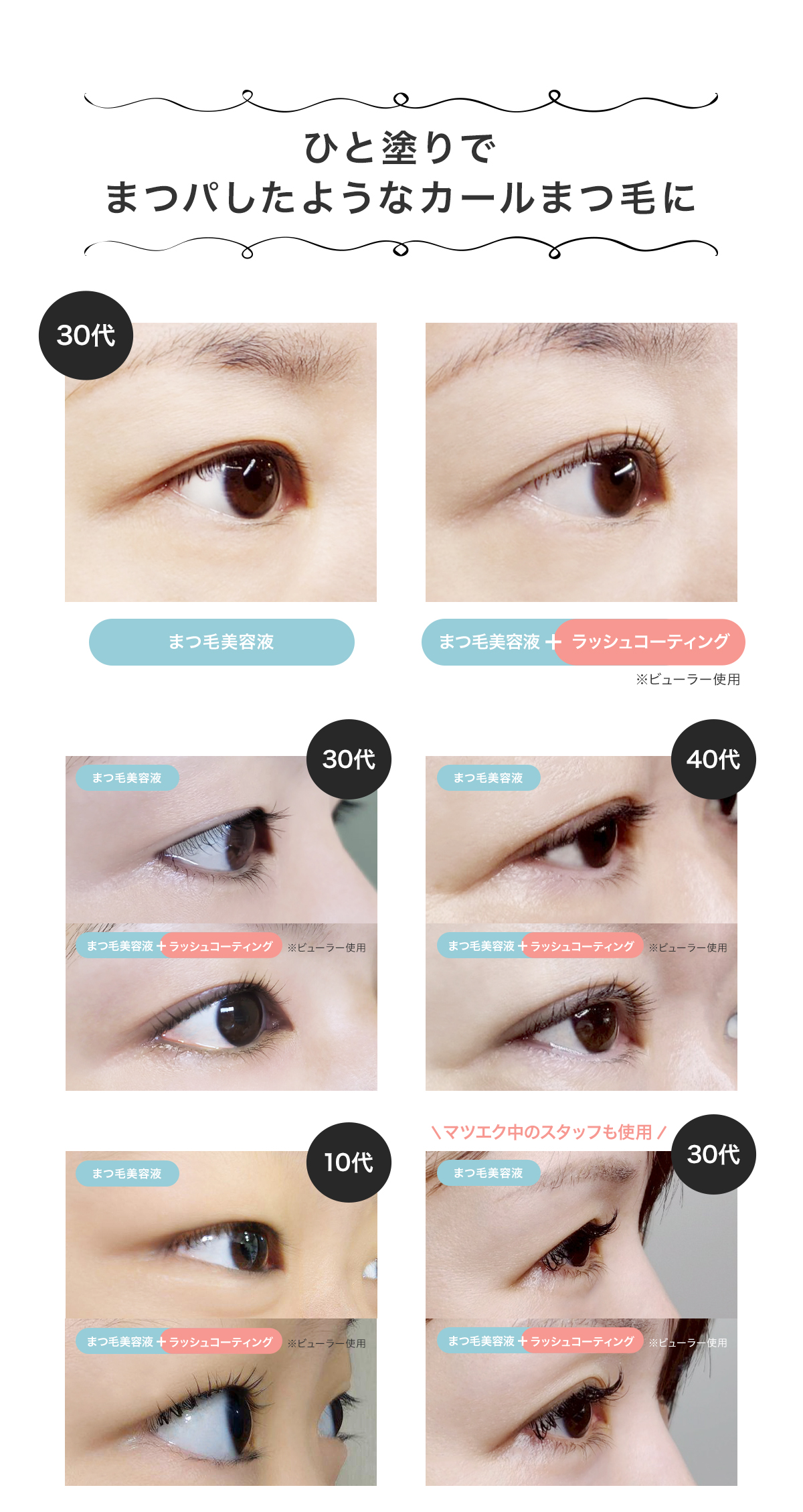 ビフォアフ
