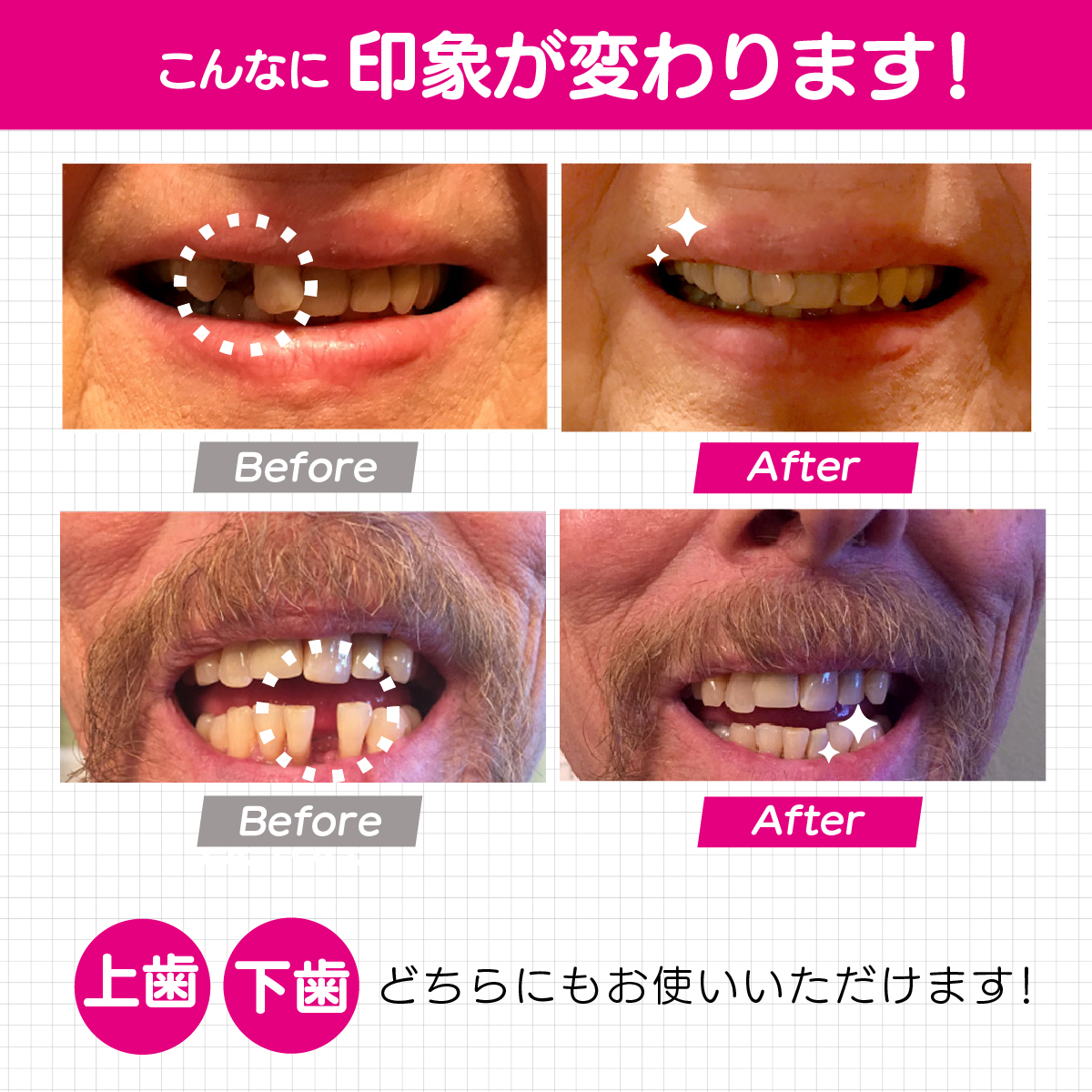 インスタントスマイルテンポラリーlp02