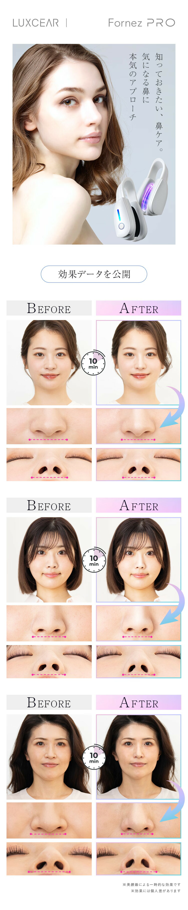 LUXCEAR（ルクセア） 鼻クリップ がっちりマンデーで紹介 LUXCEAR