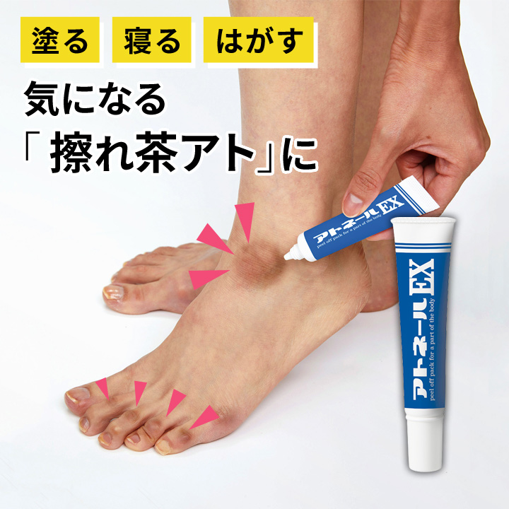 アトネールEX Z1887 黒ずみ 角質ケア くるぶし かかと 足の甲 足の指 色素沈着 古い角質 アビバーレ | マイノロジ