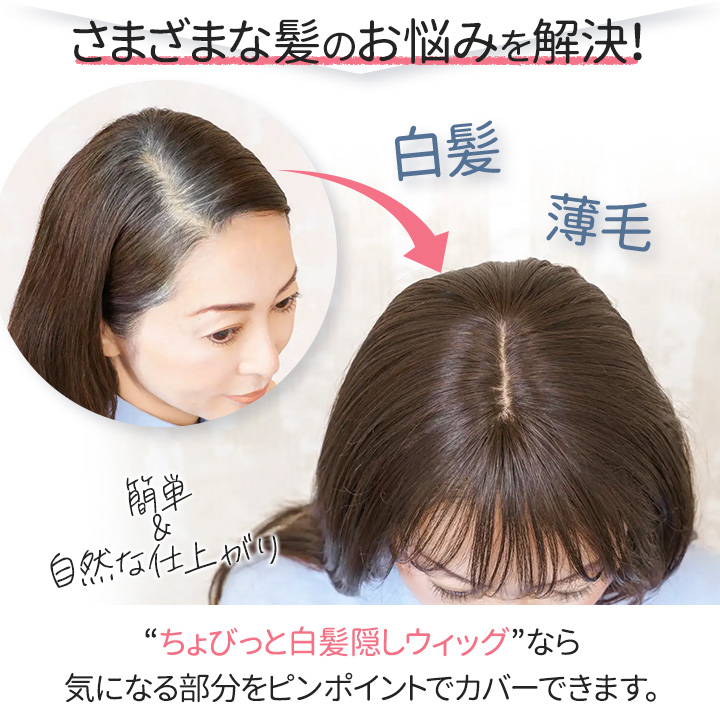 即納☆ ちょびっと白髪隠しウィッグ [Z3366] ヘアウィッグ 部分