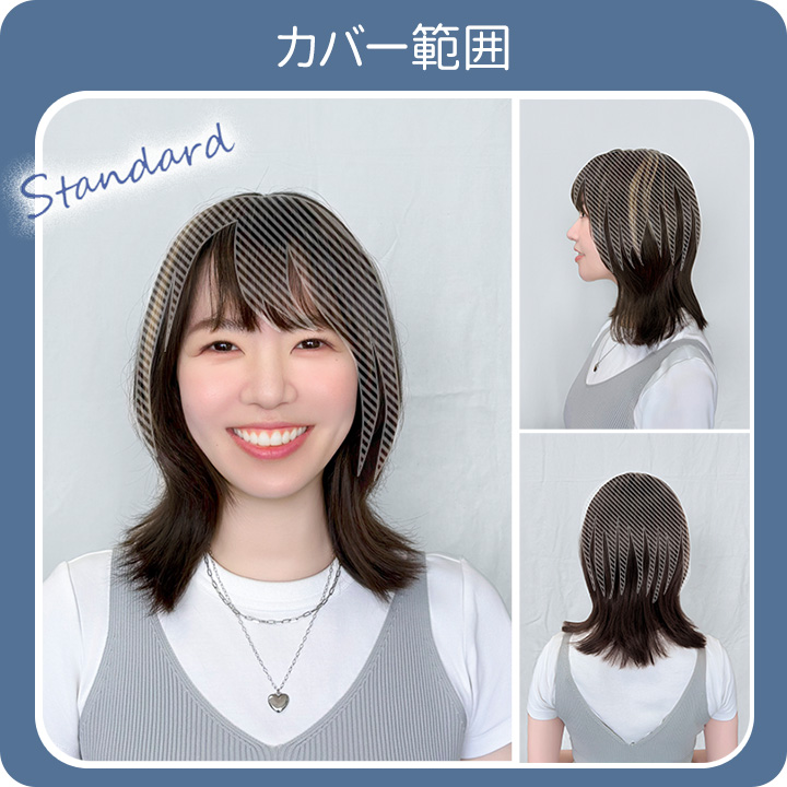 即納☆ ちょびっと白髪隠しウィッグ [Z3366] ヘアウィッグ 部分