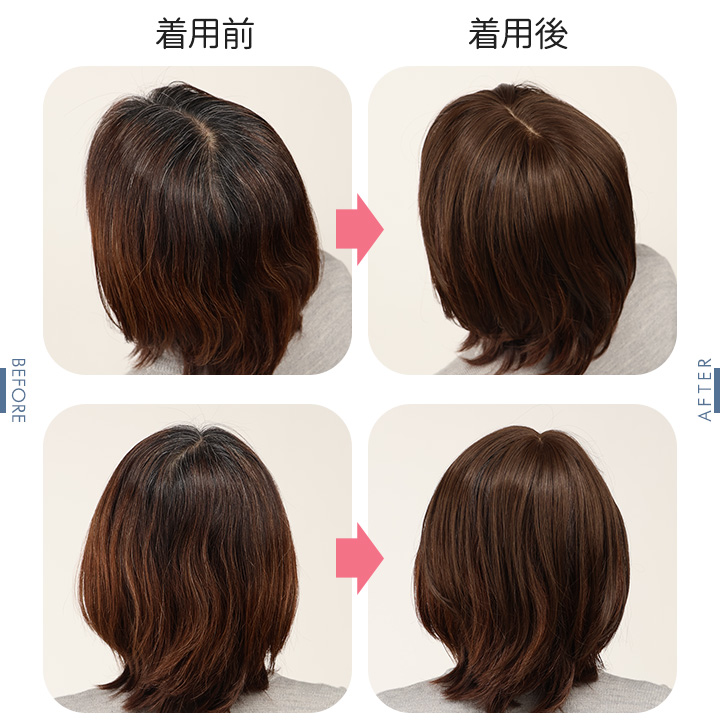 即納☆ ちょびっと白髪隠しウィッグ [Z3366] ヘアウィッグ 部分