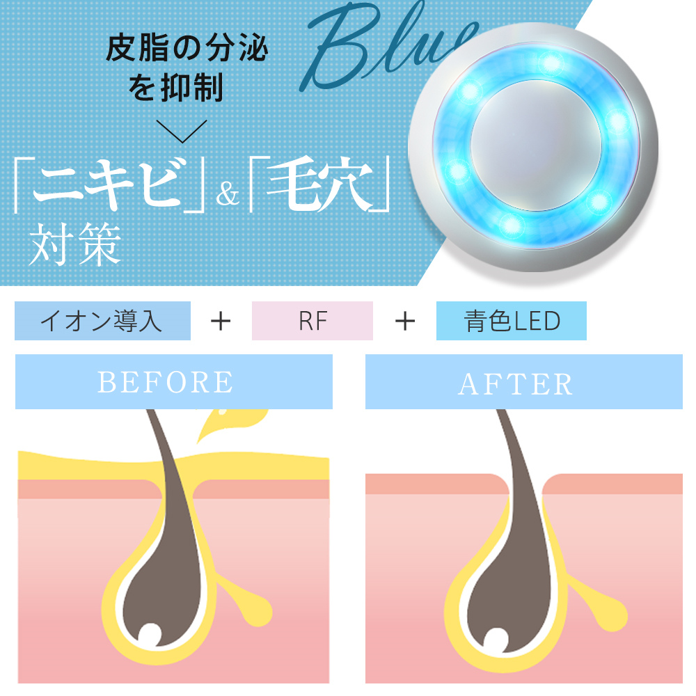 美顔器 ems ラジオ波 超音波美顔器 LED 光エステ リフトアップ