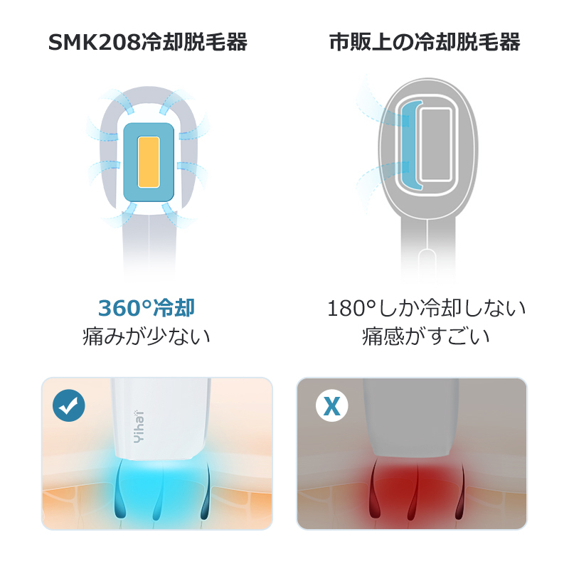 【IPL高速脱毛 360°冷却】脱毛器 冷却 99万発照射 IPL光脱毛器 光美容器 照射モード 美肌 5段階レベル ムダ毛処理 快速脱毛 LCD表示  肌センサー