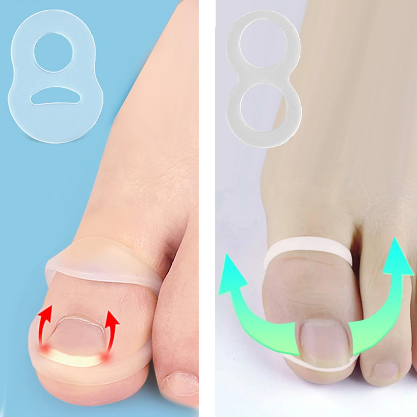 【新品未使用】巻爪矯正ドイツB/Sスパンゲプレートお好み2タイプ2種10枚セット 巻爪ケア、痛くない巻き爪矯正ならドイツで生まれたB/S式