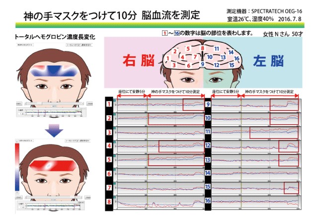 脳血流測定結果