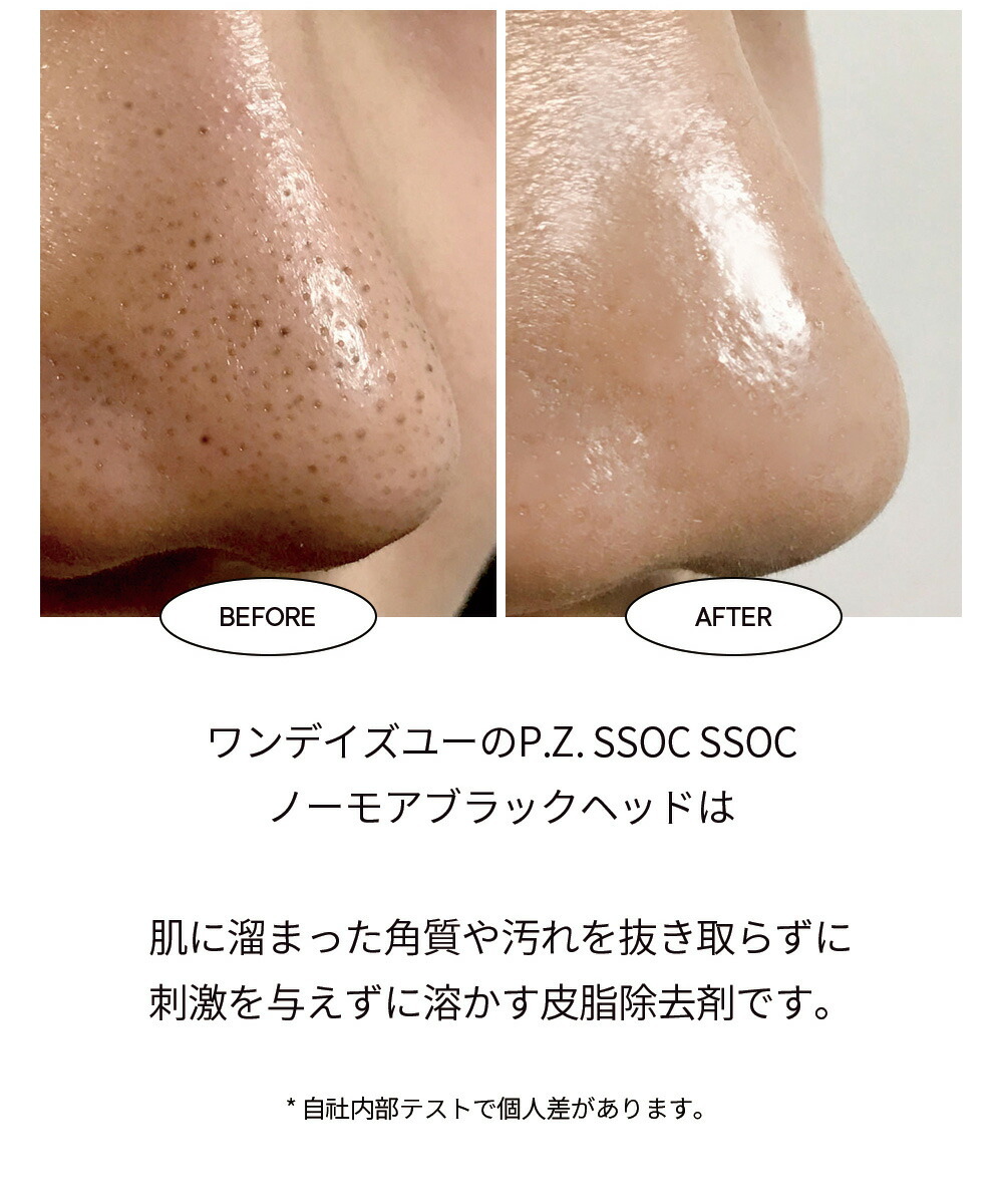 ワンデイズユー P.Z. SSOC SSOC 100ml - 基礎化粧品