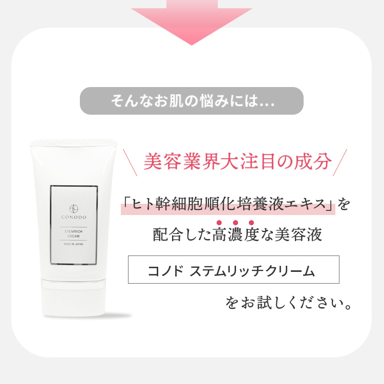 【2000円OFF】ヒト幹細胞クリーム 原液 20% 高濃度 CONODO ステムリッチクリーム 30g | CONODO | 02