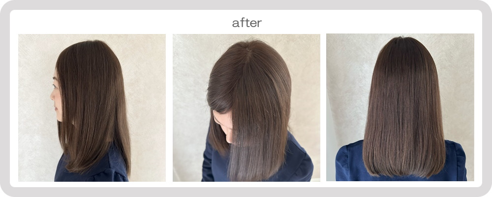 医療用 人毛100%フロントレース仕様 既製ヘアピース(PUタイプ卵型