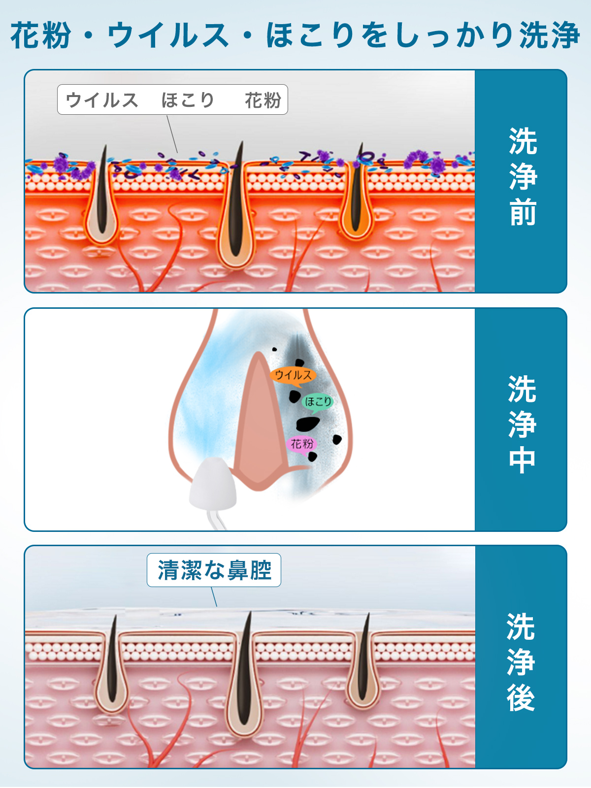割引クーポンあり+P5倍 電動鼻用洗浄器 鼻洗浄器 医療機器認証済 電動鼻うがい 鼻用洗浄器 充電式 花粉 生理食塩水 のっぴー 鼻腔洗浄器 大人 子供 花粉症 | ブランド登録なし | 08