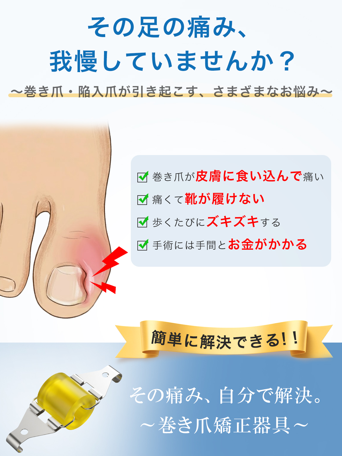 独自の超弾性設計 巻き爪矯正クリップ 巻き爪矯正器具 一般医療機器 S/Mサイズ 2枚セット 巻爪 まき爪 人気 足指 人差し指対応 関連画像2