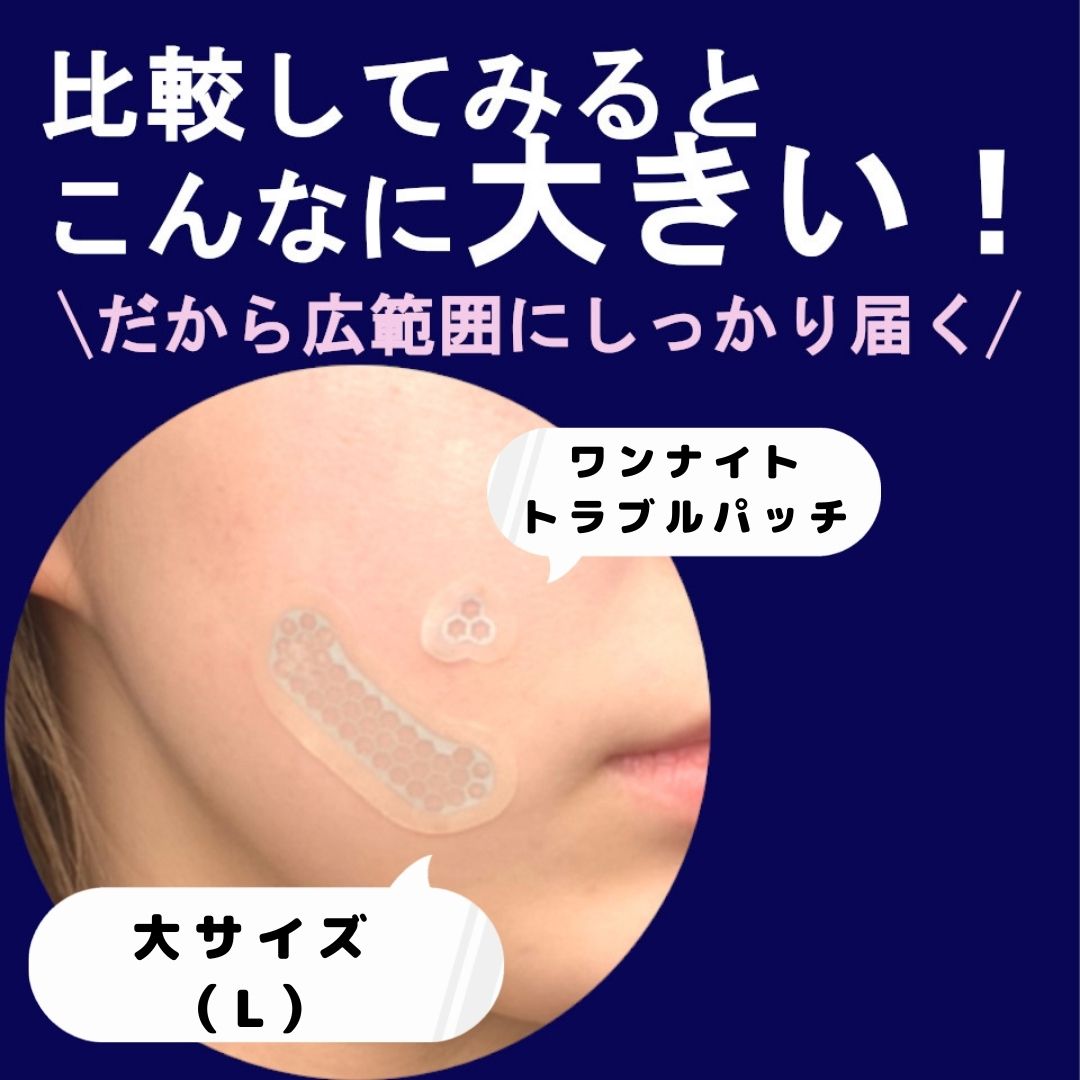 ワンナイトトラブルパッチ大きいサイズ誕生 マグネシウムマイクロ