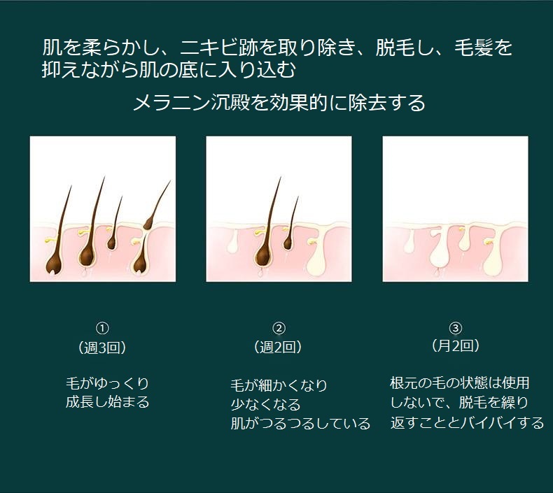PRO LASER HAIR REMOVAL 脱毛器 allure777_pr-plus