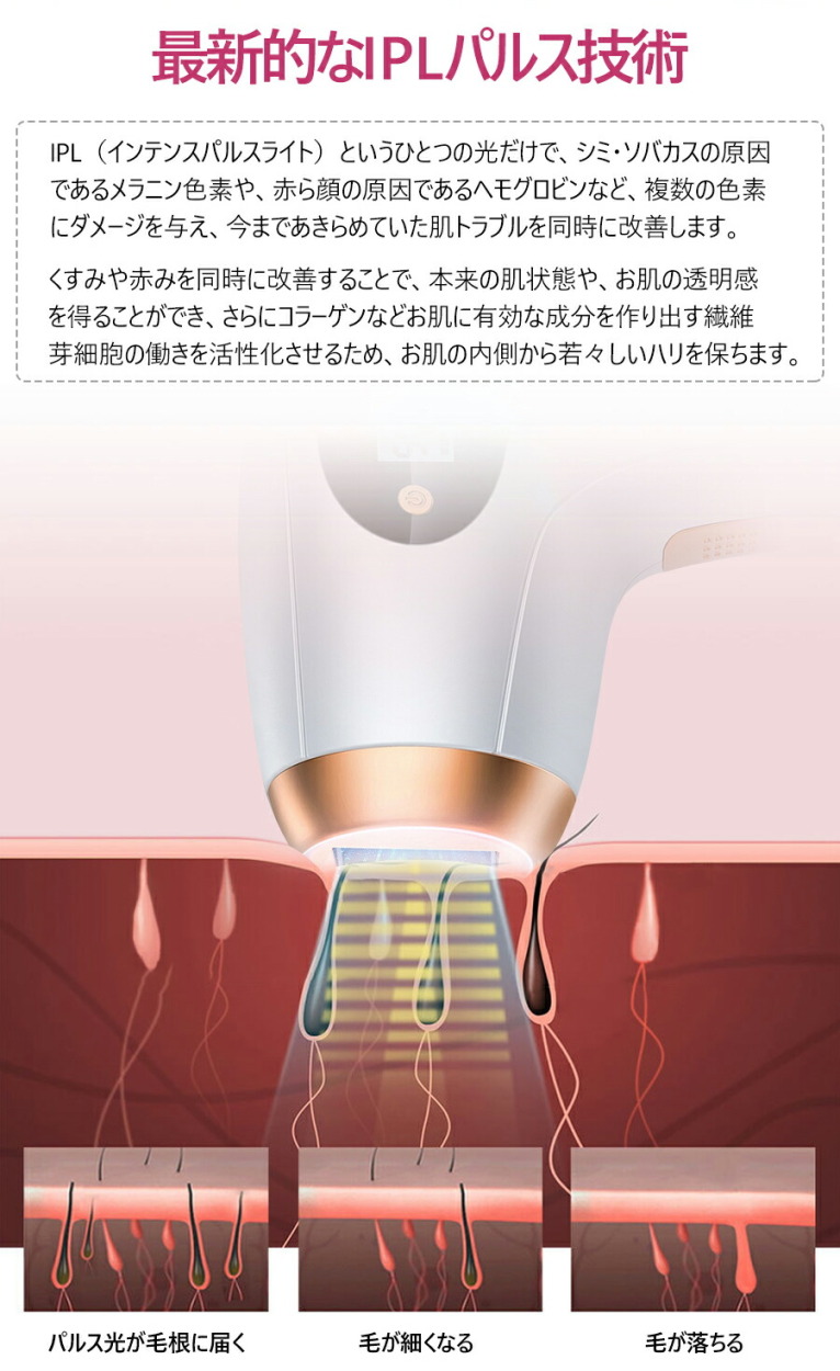 脱毛器 99万発照射 Bloomlandの脱毛器 フラッシュ脱毛器 光美容器 Vio脱毛 全身脱毛 永久脱毛 Ipl光脱毛器 自動照射 ボディ フェイスケア 家庭用 全身脱毛 髭 脇 足 顔 腕 5段階レベル Bloomland ムダ毛ケア ビキニライン Tmy