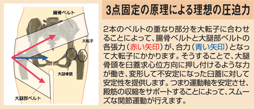 スリムヒップサポーターは股関節を安定させ痛みを軽減します。