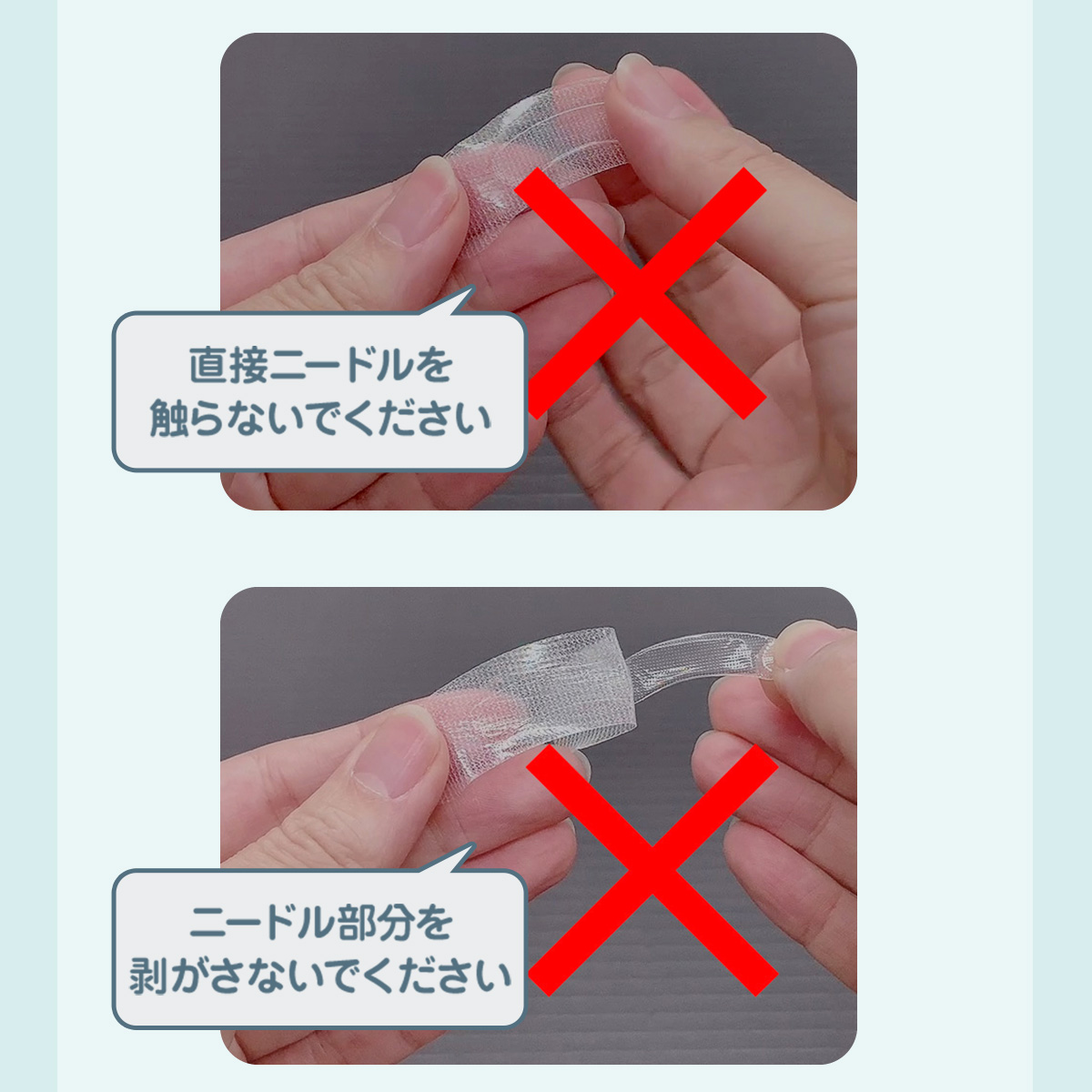ニードルパッチ