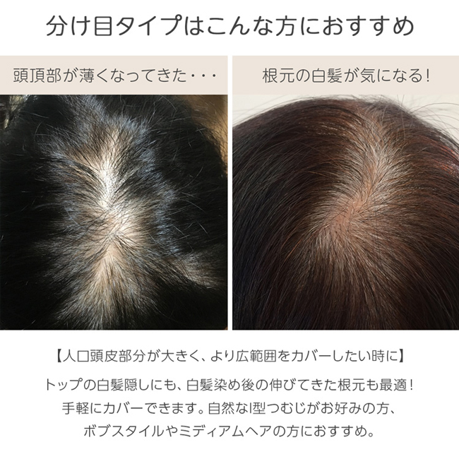 ヘアピース 人毛% 人毛  ウィッグ トップカバー 部分