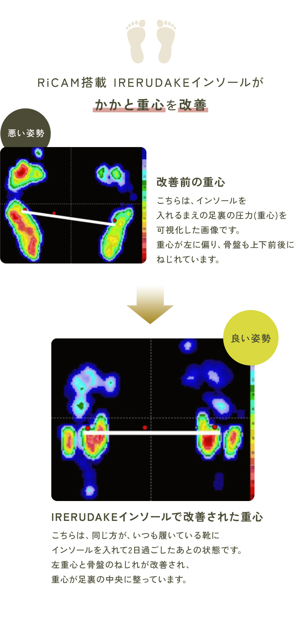 RiCAM搭載 IRERUDAKEインソールがかかと重心を改善悪い姿勢、改善前の重心 こちらは、インソールを入れるまえの足裏の圧力 (重心)を可視化した画像です。重心が左に偏り、 骨盤も上下前後にねじれています。良い姿勢 IRERUDAKE インソールで改善された重心 こちらは、同じ方が、 いつも履いている靴にインソールを入れて2日過ごしたあとの状態です。左重心と骨盤のねじれが改善され、重心が足裏の中央に整っています。 by Organic ｂｙ Ｏｒｇａｎｉｃ バイオーガニック