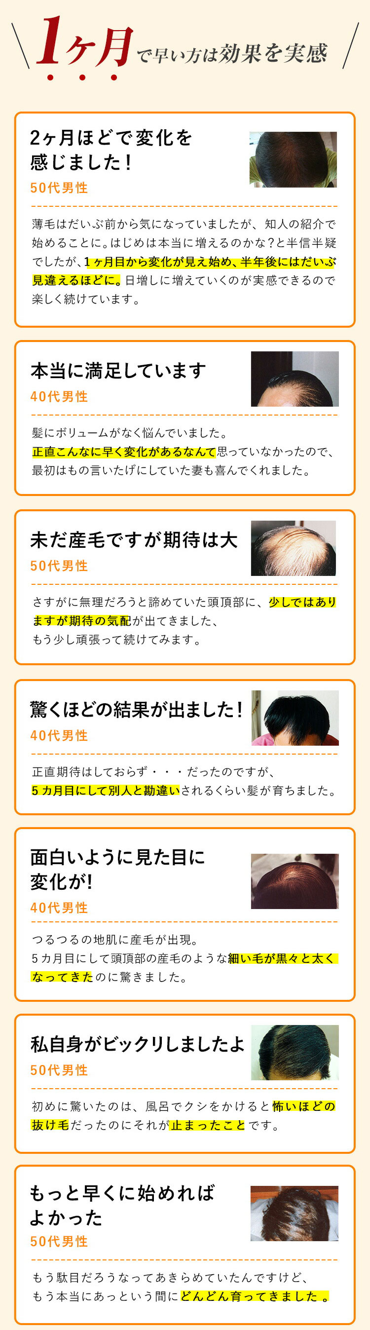 ケフトルEX 育毛剤 男性用 発毛 促進剤 薬用 育毛トニック