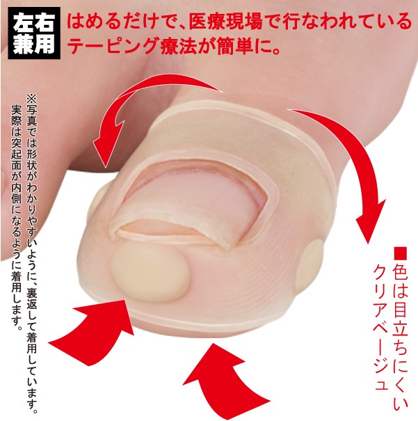 【巻き爪対策】[勝野式巻き爪&サムリング(2個組）]皮膚に食い込んで痛い巻き爪の痛みに。【巻き爪ケア】【巻き爪予防】【テーピング】【巻爪】