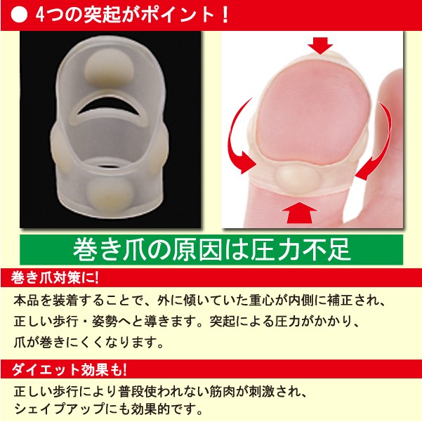 【巻き爪対策】[勝野式巻き爪&サムリング(2個組）]皮膚に食い込んで痛い巻き爪の痛みに。【巻き爪ケア】【巻き爪予防】【テーピング】【巻爪】