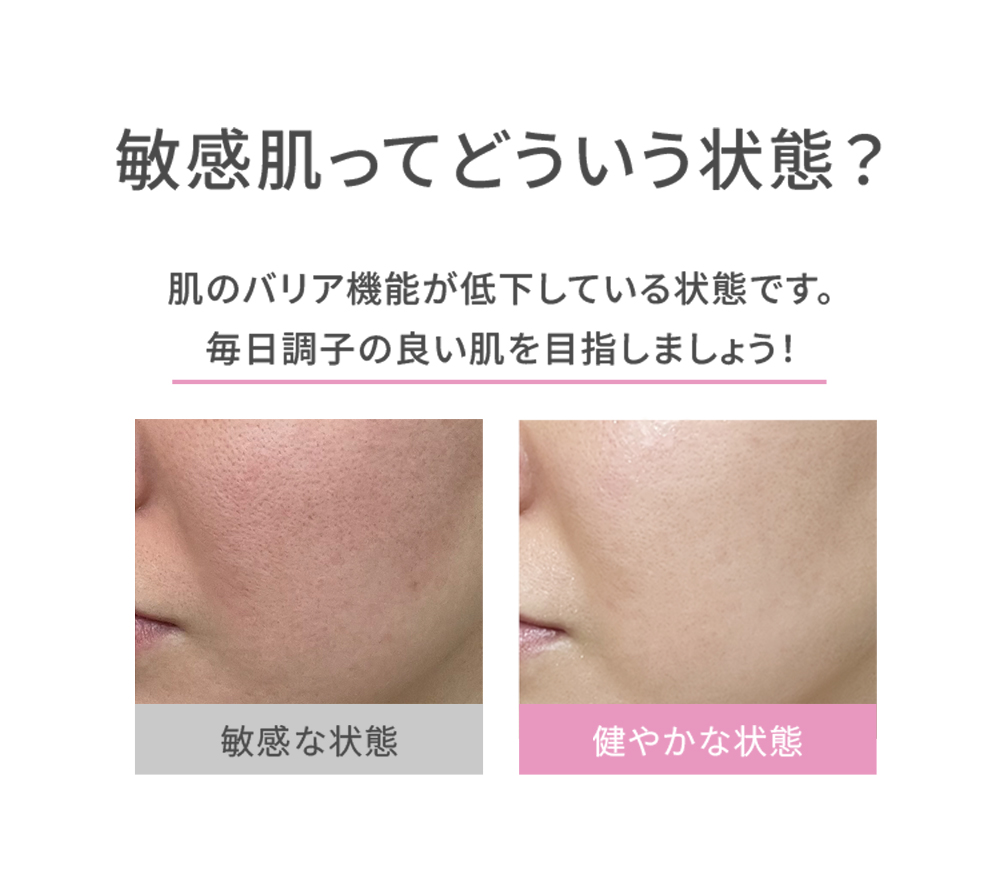 NEW ドクターシーラボ 薬用ローション センシティブEXa 145mL 化粧水 ローション 医薬部外品 敏感肌 低刺激 トナー さっぱり スキンケア | Dr.Ci：Labo | 02