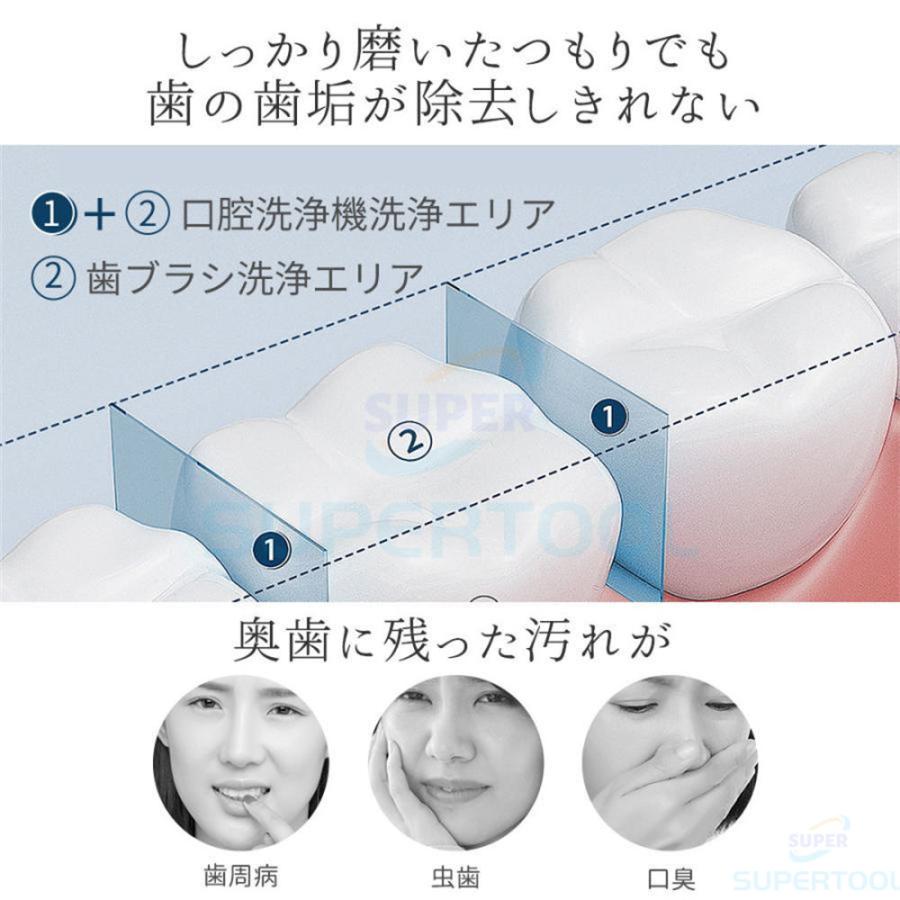 口腔洗浄器 ジェットウォッシャー 3段階調整 歯間洗浄機 超音波 口内