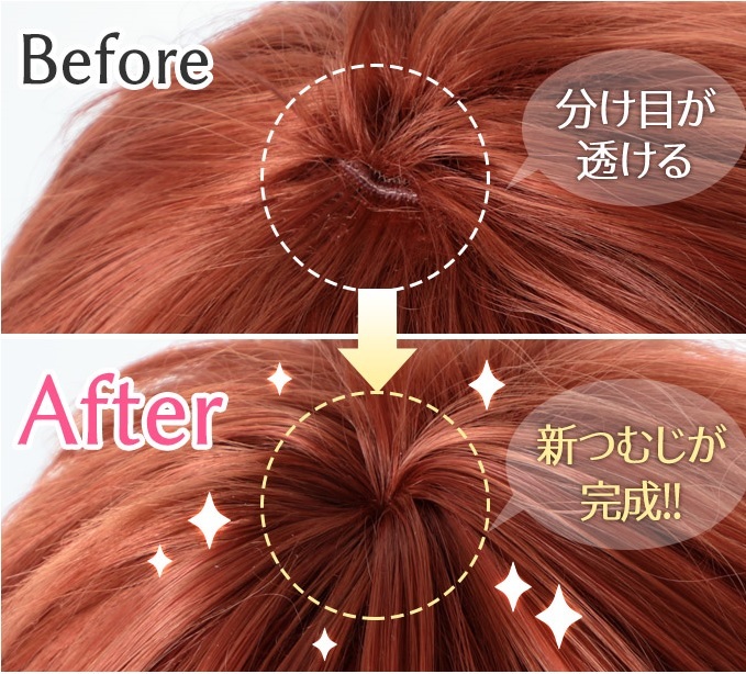 Before 分け目が透ける After 新つむじが完成!!